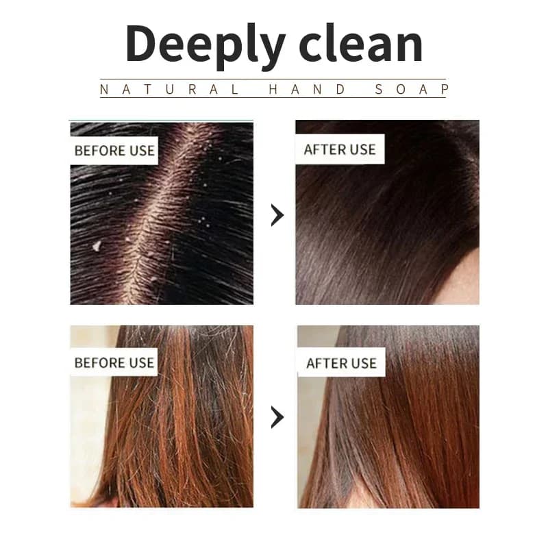 Le shampooing à la lavande est rafraîchissant, contrôlant l'huile et lisse pour les cheveux, résout le problème du cuir chevelu gras sans huile de silicone res